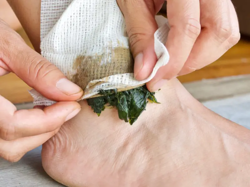 Applying a comfrey poultice for joint or muscle pain relief.